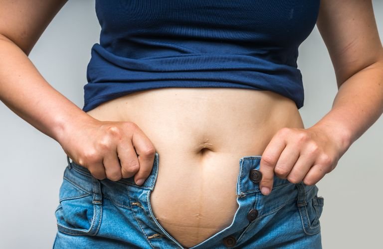 Pérdida de Peso Saludable: Enfoque Integral para Mujeres